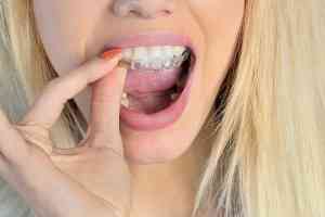 © deeaf - fotolia.com Zahnspange